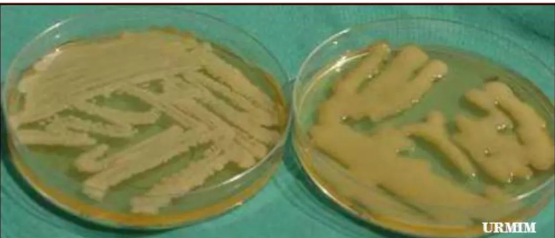 Figura  8:  Cultivo  de  Cryptococcus  em  Agar  Sabouraud  Dextrose:  À  esquerda  C