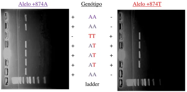 Figura 7 – Fotografia da eletroforese do produto amplificado por ASO-PCR de 262pb da  região intrônica +874T/A do gene IFNG (Fonte: Laboratório de Virologia/ICS/UFPA)