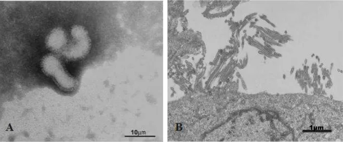 FIGURA  3.  Micrografia  eletrônica  do  vírus  Influenza  A  (H1N1)  pandêmico  cultivado  em  cultura  de  células  de  rim  de  canino  (MDCK)