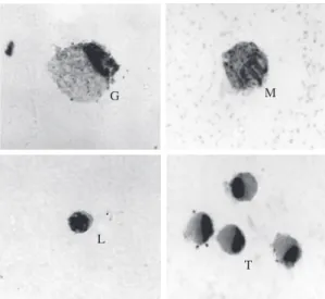 Figure 4. Comparison among cells from the exudate of the  swim bladder of the hybrid tambacu and related cells from  the circulating blood