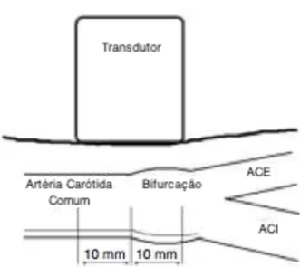 Figura 11 .  Circulação carotídea e a posição do transdutor. ACE = Artéria carótida externa