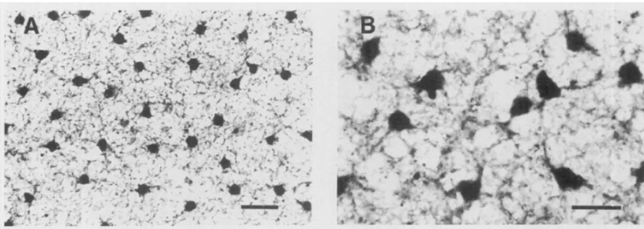 Figura  8.  Micrografia  de  células  horizontais  da  retina  de  rato.  Focada  na  borda  camada  plexiforme  externa/camada  nuclear  interna