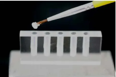 Figura 3 Inserção de resina acrílica incolor na perfuração onde será adaptado o implante.