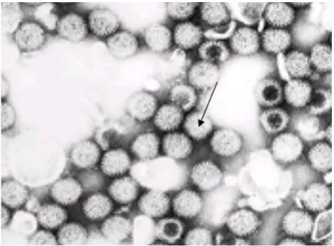 Figura 1: Partículas de rotavírus semelhante ao formato de “roda” quando visualizadas por ME