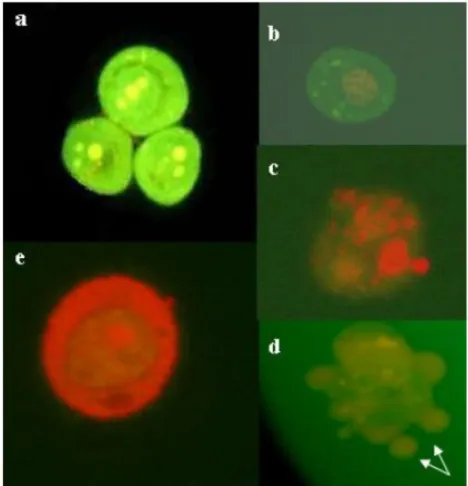 Figura 6 - Foto mostrando células submetidas a marcação fluorescente diferencial com laranja  de acridina/brometo de etídio