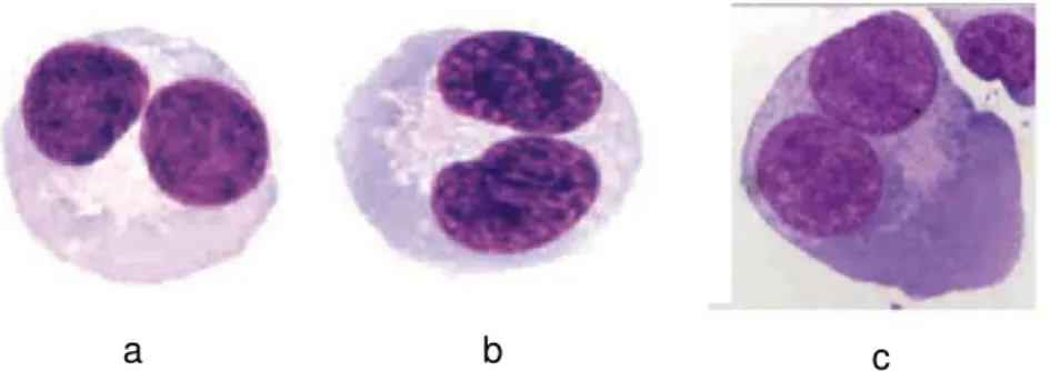Figura 8 - Fotomicrografias ilustrando diversos aspectos de células binucleadas (coradas com  Giemsa) que se enquadram nos critérios de análise