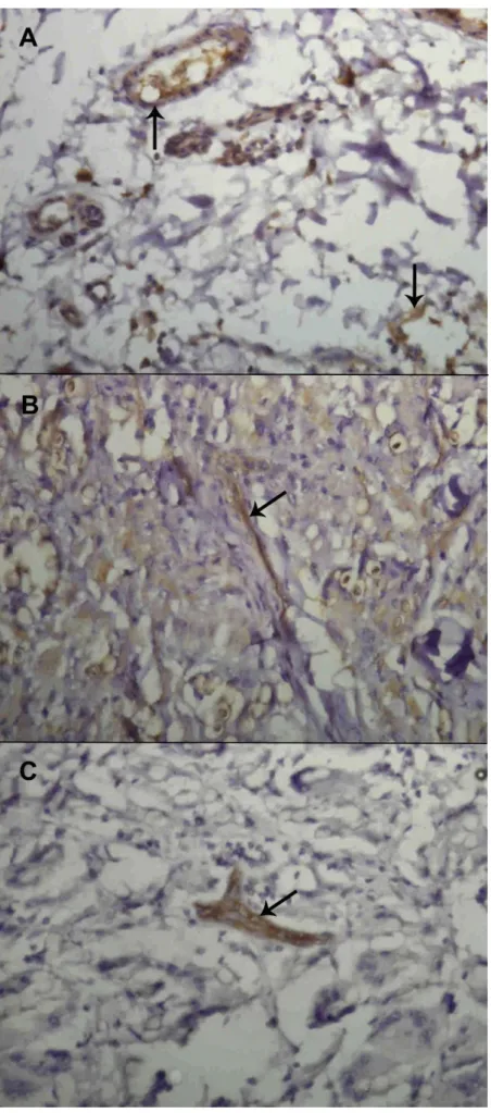 FIGURA 7: Micrografia da marcação imunohistoquímica de moléculas de adesão celular na lesão durante  doença  de  Jorge  Lobo