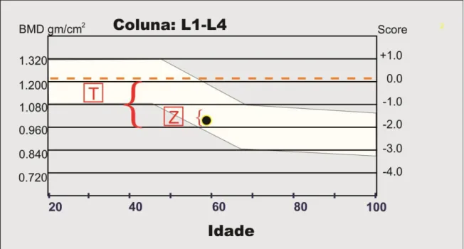 Figura 09: Variação de Z e T escores na coluna lombar conforme idade. 