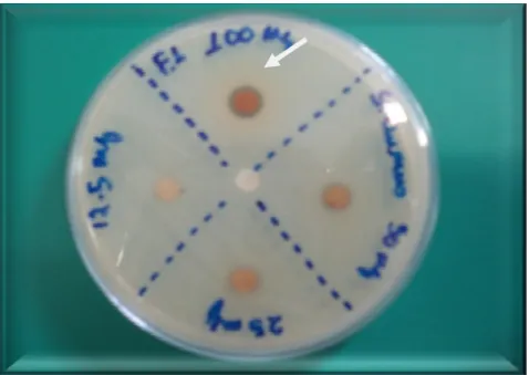 Figura 7 – Atividade antimicrobiana da fração metanólica de Uncaria guianensis com ação na  concentração de 100mg (halo de 8 mm)