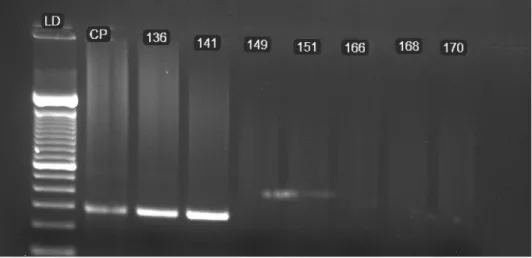 Figura 8 - Eletroforese em gel de agarose com produto da segunda PCR de 278 pb. LD  representa o peso molecular de 100 pb; CP o controle positivo