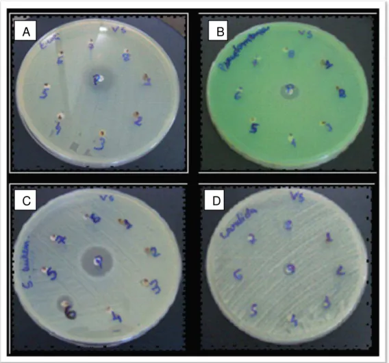 Figura 6- Avaliação da atividade antibacteriana e antifúngica pelo ensaio de difusão em  Agar