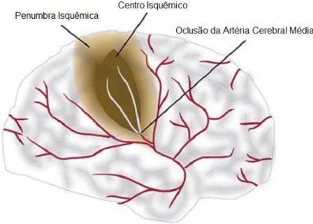 Figura  1:  Oclusão  da  artéria  cerebral  média  provocando  isquemia  cerebral.  Desenvolvimento  do centro isquêmico e da região de penumbra