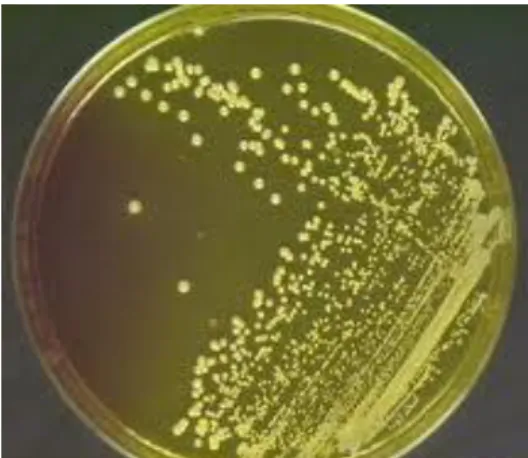 Figura 4 - Cepa de Staphylococcus aureus MRSA isolado em Agar manitol salgado     http://medchrome.com/wp-content/uploads/2010/05/s.aureus-agar.jpg