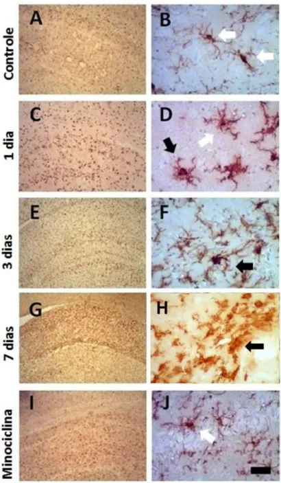 Figura 5:  Imunoreatividade microglial  revelada pela imunoshistoquímica  para  Iba1 na  região  CA1  do  hipocampo