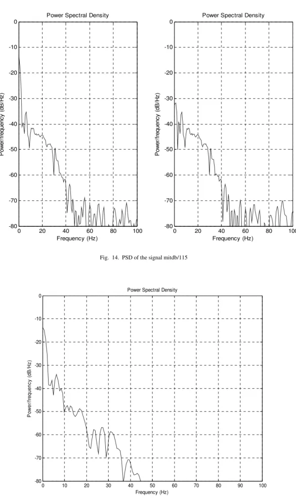 Fig.  15.  PSD of the output of EMD IIT algorithm: mitdb/ 115 