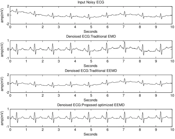 Fig.    11.    ECG  signal  generated  by  MATLAB  function:  a)  Noisy  input  signal    b)  Denoised  ECG  signal:  Traditional  EMD  c)  Denoised  ECG  signal: 