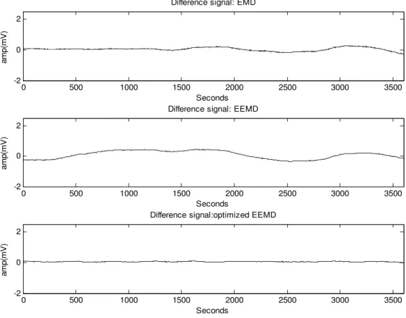 Fig.  12.  ECG generated by MATLAB function: Difference signal of noisy input and output of all methods