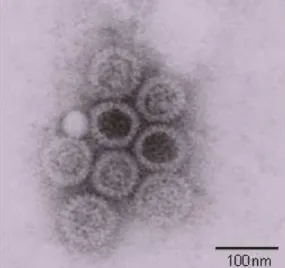 Figura  1.  Visualização  da  micrografia  eletrônica  de  extrato  fecal  contendo  partículas  completas de RV