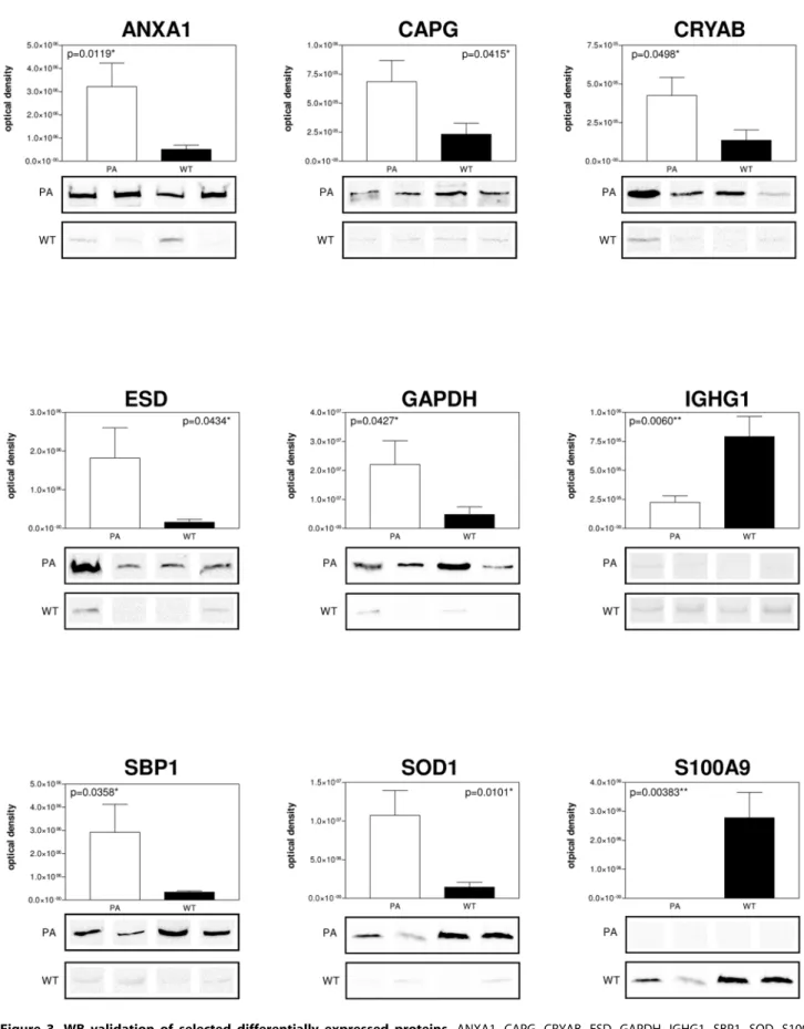 Figure 3. WB validation of selected differentially expressed proteins. ANXA1, CAPG, CRYAB, ESD, GAPDH, IGHG1, SBP1, SOD, S100A9 different expression by immunoblot analysis