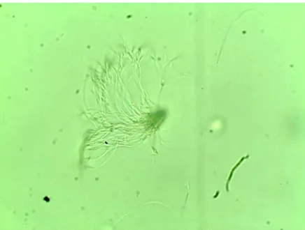 Figura 1 –  Feixe de espermatozoides nas vesículas seminais de machos de Melipona  flavolineata  (aproximadamente  50  células  aglomeradas)