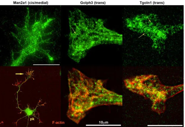Figure 13. Hippocampal pyramidal neurons and/or their axonal growth cones labeled with antibodies to proteins involved in proteasomal degradation (top row)