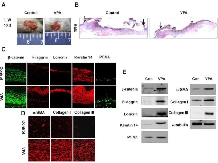 Figure 4. Effects of VPA on cutaneous wound healing in large wounds. A full-thickness skin excision (diameter = 1.5 cm) was made on the backs of 8-week-old C3H mice, and 500 mM VPA was topically applied to the wounds daily