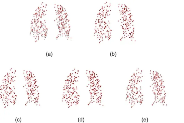 Figure 11. 3D lung point set registration on a subject. (a) 3D lung point sets before registration, (b) SMM-based algorithm, (c) CPD, (d) TPS-L2, (e) TPS-RPM
