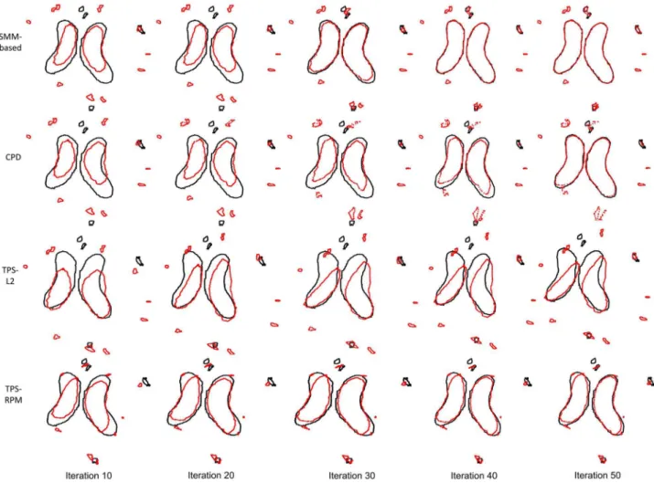 Figure 6 shows the non-rigid registration results produced by our SMM-based algorithm, CPD, TPS-L2 and TPS-RPM on the 3D face data, respectively