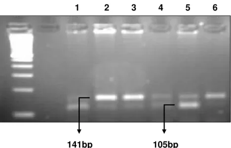Figura  5:  Imagem  ilustrando  o  SNP  na  posição  -137  em  gel  de  eletroforese  a  3%  representando  amostras  tratadas  com  a  enzima  de  restrição  Bgl  II  (RFLP-PCR)