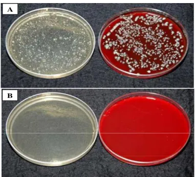 Figure  1.  Petri  dishes  containing  culture  media  PCA  (left)  and  blood agar (right) after incubation for 48 hours, showing numerous  colony forming units (CFU) in the control group (A) and absence of  CFU  to  attest  sterility  in  the  group  tha