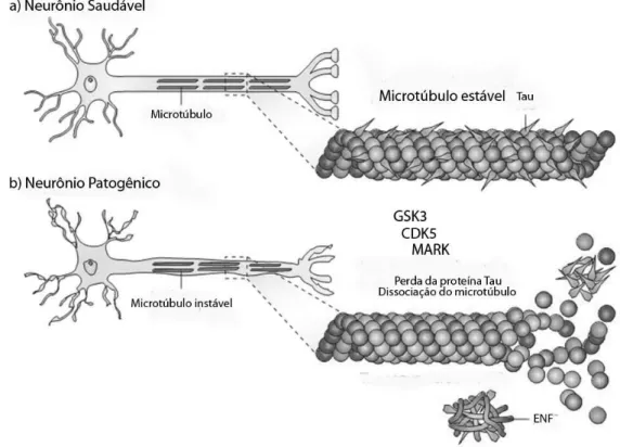Figura  7:  Desenho  esquemático  representando  o  desempenho  da  proteína  TAU  em  neurônios  saudáveis  (a)e  patológicos (b)