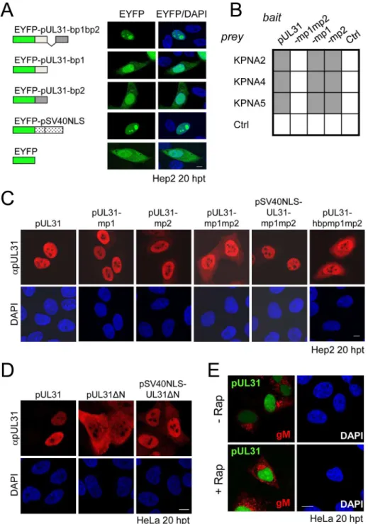 Fig 2. The N-terminal domain of pUL31 contains a classical bipartite NLS. (A) Hep2 cells were transfected with plasmids encoding the EYFP-pUL31-bp1bp2, EYFP-pUL31-bp1, EYFP-pUL31-bp2, or EYFP-SV40NLS fusion proteins; EYFP lacking an NLS was used as negativ