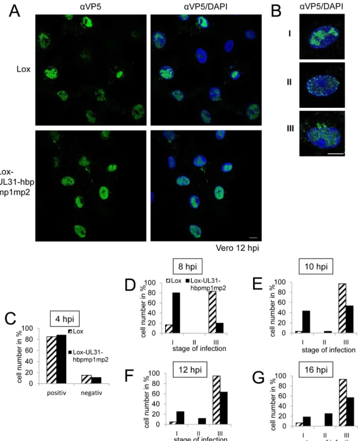 Fig 7. Nucleocapsids of HSV1(17 + )Lox-UL31-hbpmp1mp2 are impaired in nuclear egress. (A, B; D-G) To analyze the subcellular localization of nucleocapsids, Vero cells were infected at an MOI of 1 with HSV1(17 + )Lox or Lox-UL31-hbpmp1mp2, fixed at various 