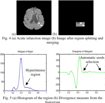 Fig. 4 illustrates the DWI of acute infarction. Fig. 4 (a)  shows the pre-processed image