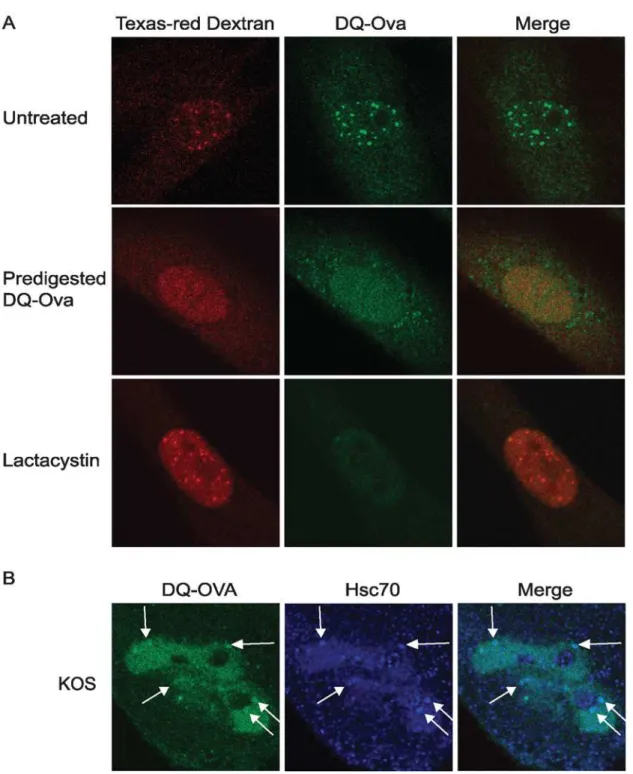 Figure 5. Protease activity is detected in VICE domains. (A) HFF-1 cells were plated in dishes containing embedded glass coverslips and were microinjected with TX red dextran and the 20S proteasomal substrate DQ-OVA