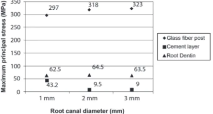 Figure 4-   Maximum  principal  stress  (MPa)  for  various  root  canal  diameters  (1  mm,  2  mm,  and  3  mm)  with  a  constant glass iber post diameter of 1 mm