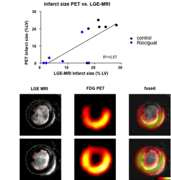 Figure 3. Assessment of infarct size via consecutive LGE-MRI and FDG-PET. (A) There was a good correlation between infarct size measured with LGE-MRI and FDG-PET