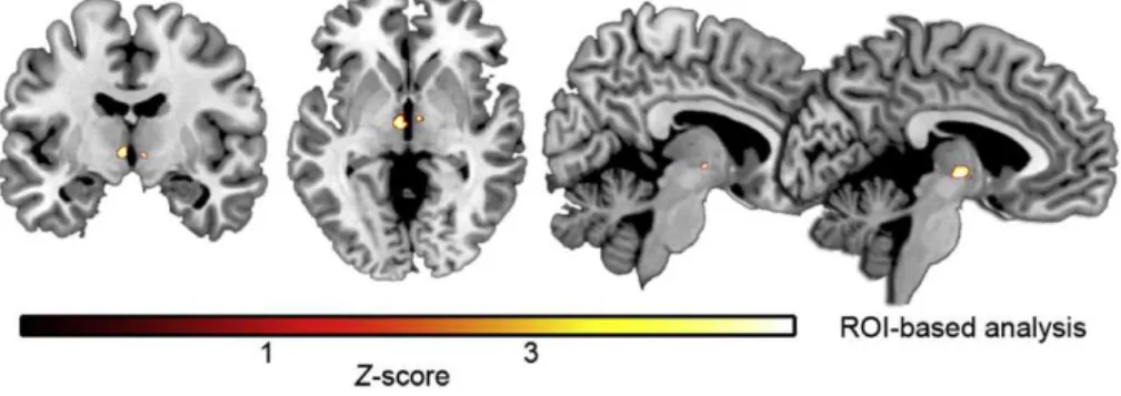 Fig. 2. Box-and-whisker plots of thalamic volumes for patient and control groups.
