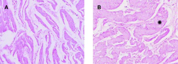 Figure 2 –  Histological section of rabbit bladder. A) Absence of muscular hypertrophy in group G1 (HE, X40)