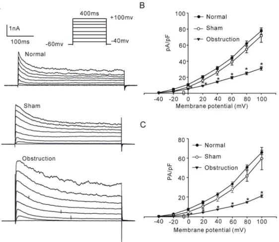 Figure 3. Comparison of IK V in normal sham and obstruction groups. A shows representative current traces elicited from a holding potential of 260 mV using voltage steps of 400 ms from 240 mV to +100 mV in 20 mV increments