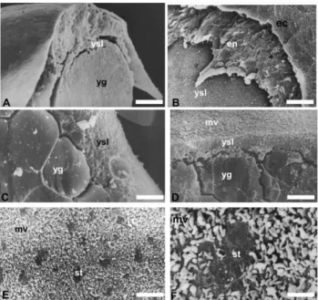 Figure 3 Eletronmicrographies (SEM) of cryofractured P.