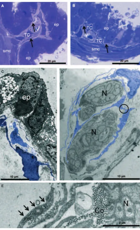 Fig. 3 Prostate semi-thin sections for light microscopy and ultra-thin sections for transmission electron microscopy