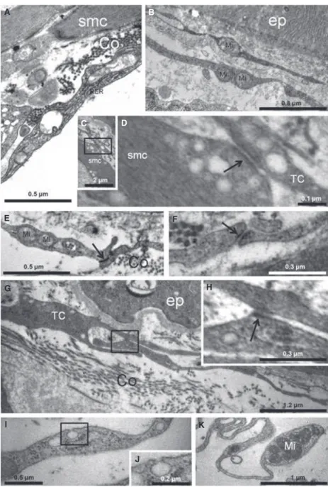 Fig. 5 Transmission electron microscopy.