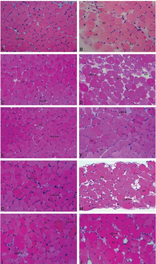 Fig 2. Light micrographs of mouse diaphragm muscles submitted to hematoxylin and eosin staining.