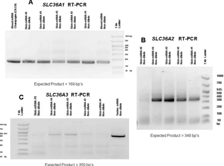 Figure 4. RT-PCR product results for SLC36A1 , A2 and A3 . A) RT-PCR results for SLC36A1