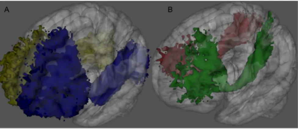 Figure 3. Schematic representation of the cortical regions connected by the IFOFq. 3D schematic representation in the MNI space of the Freesurfer-based regions, which showed connections through the IFOFq (left lateral view)