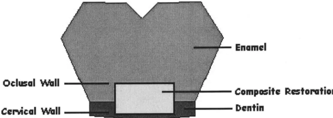 FIG.  1. Scheme  of  class  V cavity  preparation  location.