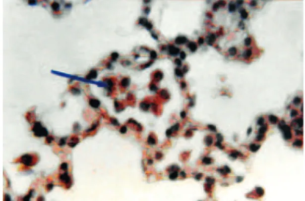Fig 2: Photomicrograph of an alveolus in the experimen- experimen-tal group, the exfoliated cells have been shown with arrow  (×400 , H &amp; E staining) .