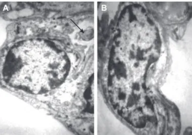 Fig 5: Electron micrograph of type I pneumocyte (big ar- ar-row) and type II pneumocyte (arrow head) with electron  dense inclusions (arrow) (×3000)