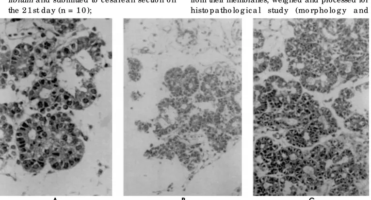 Figure 5 - Pancreas of newborn rats obtained on the 18th day of pregnancy from the group receiving the diet ad libitum (A), the group submitted to protein-calorie restriction from the 1st day (B) and the group submitted to protein-calorie restriction after